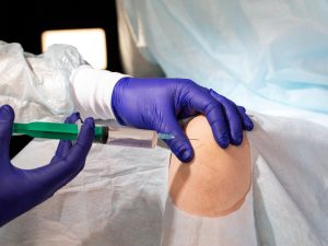 The doctor makes a therapeutic intra-articular injection into the knee joint to relieve inflammation and pain. Therapeutic injections for the restoration of knee cartilage, plasma therapy